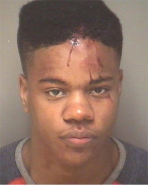 Martese Johnson brutalized by Alcoholic Beverage Control police, March 18.  
